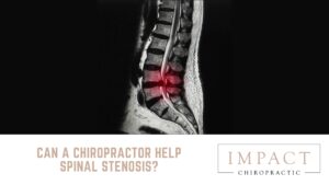 Can a Chiropractor Help Spinal Stenosis?