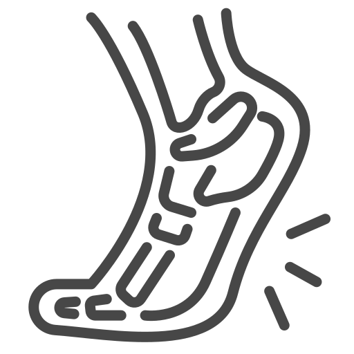 plantar-fasciitis plantar-fasciitis